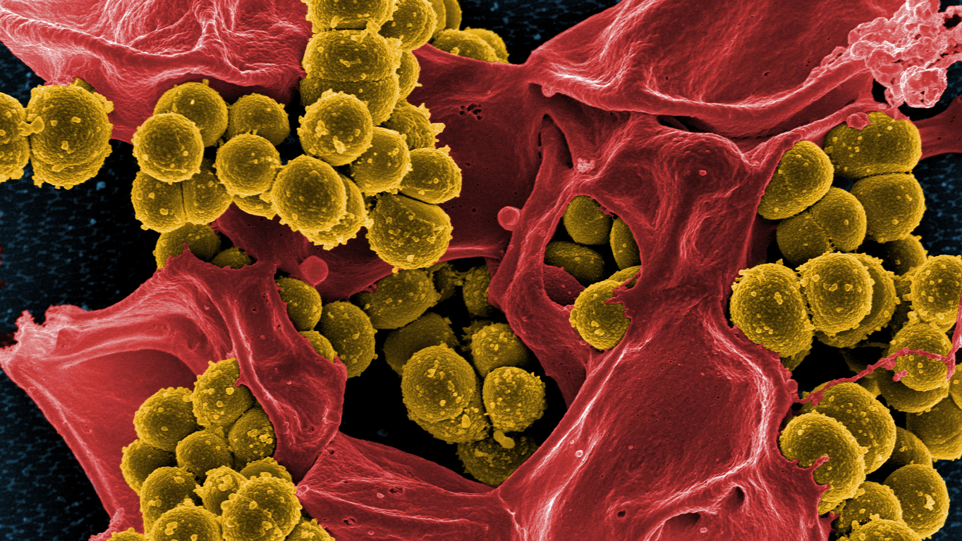 Mikrograf staphylococcus aureus (mrsa) yang resisten methisilin, bakteri dengan sel melingkar