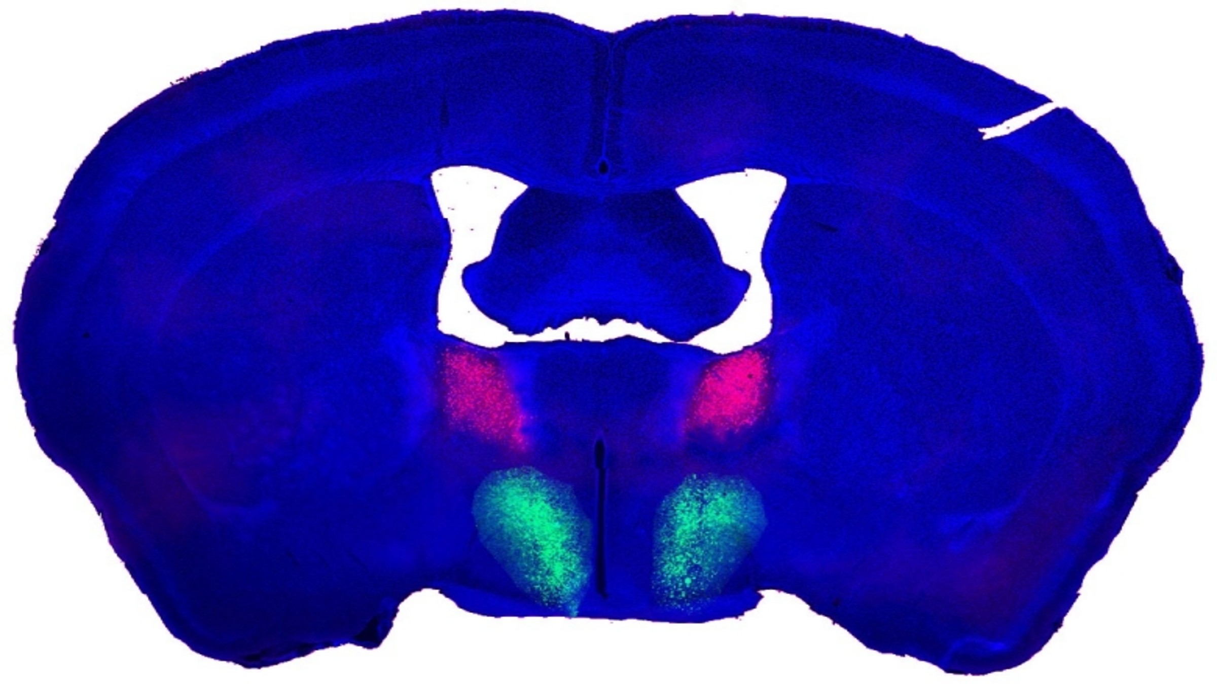 Gambar komposit otak tikus jantan yang menunjukkan hipotalamus preoptik dan nukleus dasar stria terminalis