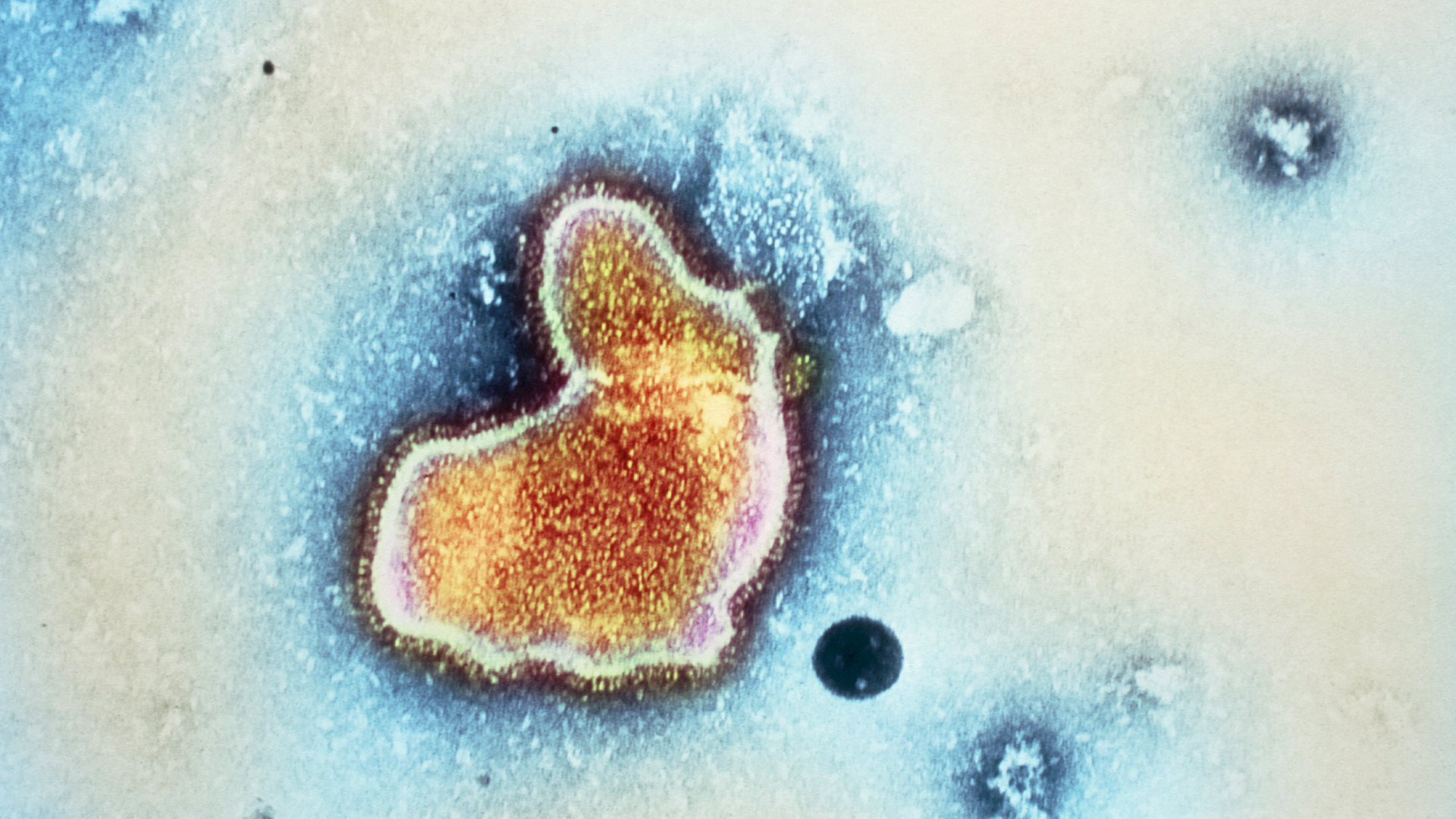 Mikrograf elektron transmisi berwarna (TEM) dari virus pernapasan syncytial (RSV).